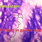 Helicobater pylori: Introduction, Morphology, Pathogenecity, Lab Diagnosis, Treatment and Prevention