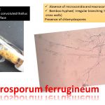 Microsporum: General Characteristics, Pathogenesis, Clinical Findings, Laboratory Diagnosis, Epidemiology, Prevention and Control