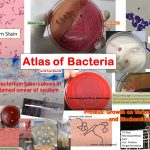 Atlas of Bacteria: The name ‘ Atlas of Bacteria’ is given even due to the vast spectrum of bacteriology but puny collection and another thing is that only an epic centre collection of my authentical performance. So, please if you have benefited from this atlas, let others know about it too and share them through social media.