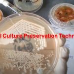 Fungal Culture Preservation- The main objectives of fungal culture are to grow the organisms, isolate the organisms, and if necessary preserve the organisms. A fungal culture is a genetic resource and thus fungal culture preservation is applicable for the following purposes; Germplasm conservation Developmental studies Industrial Application Research programs