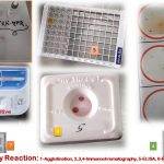 Antigen Antibody Reaction Based Tests- Introduction, Types with Descriptions and Application