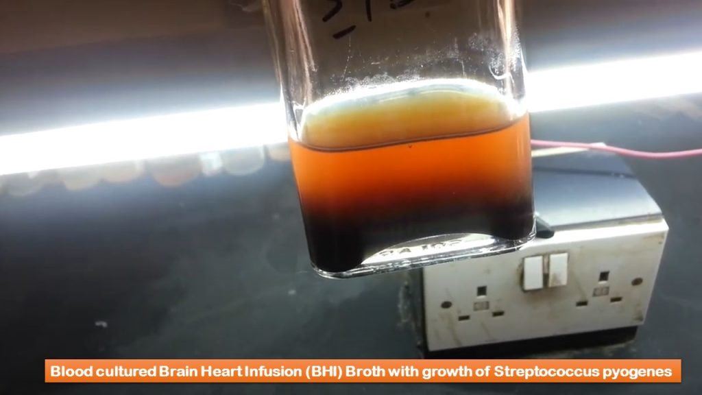 BHI Broth: Introduction, Composition, Principle, Preparation, Test Procedure and Uses