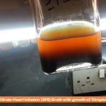 BHI Broth: Introduction, Composition, Principle, Preparation, Test Procedure and Uses