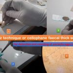 Kito- Katz Technique: Introduction, Principle, Procedure, Result Interpretation, Applications and Keynotes