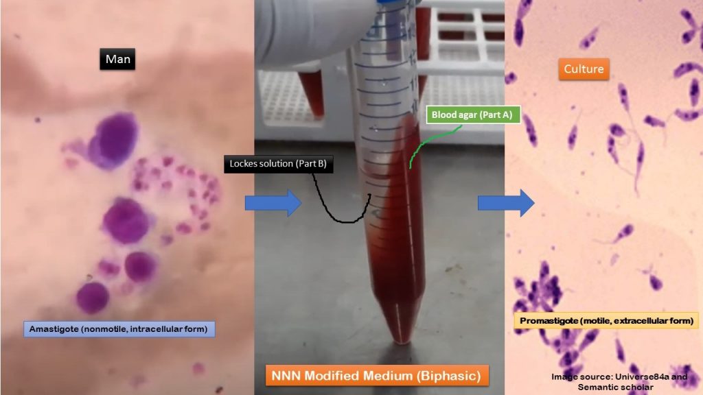 NNN Medium: Introduction, Composition, Preparation, Culture Procedure and Result Interpretation