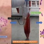 NNN Medium: Introduction, Composition, Preparation, Culture Procedure and Result Interpretation