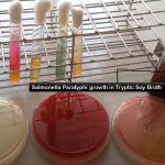 Tryptic Soy Broth (TSB): Introduction, Composition, Principle, Preparation, Test Procedure and Uses