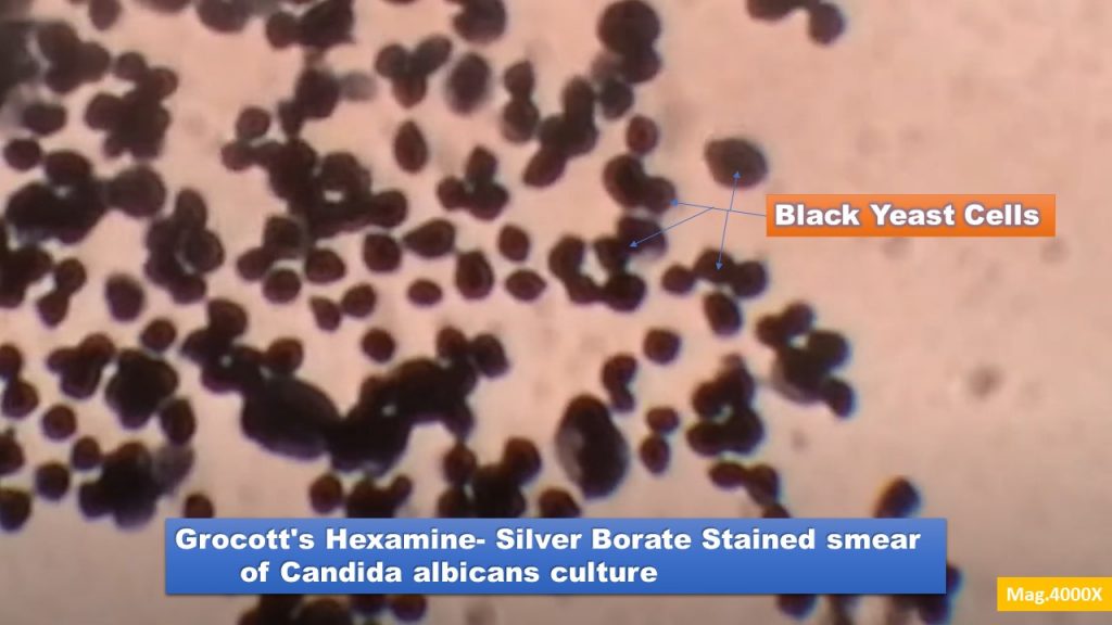 Grocott's Hexamine- Silver Borate Stain: Introduction, Principle, Procedure, Result Interpretation