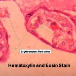 Hematoxylin and Eosin Stain: Introduction, Principle, Procedure, Result Interpretation and Keynotes