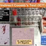 Indirect Coomb Test (ICT): Introduction, Principle, Procedure, Result Interpretation and Clinical Significance