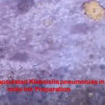 Negative Staining for Bacterial Capsule Demonstration: Introduction, Principle, Procedure and Result Interpretation