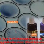 Weil Felix Test for Rickettsial Diseases: Introduction, Principle, Procedure, Result Interpretation and Keynotes