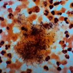 Actinomyces: Introduction, Classification, Morphology, Pathogenecity, Lab Diagnosis, Treatment and Keynotes