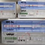 Antibody (Ab): Introduction, Structure, Theory of Production, Classes and Properties