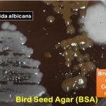 BSA Introduction, Principle, Composition, Test Procedure, Colony Characteristics and Uses
