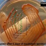 Bird Seed Agar: Introduction, Principle, Composition, Test Procedure, Colony Characteristics and Uses