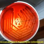 Blood Agar (BA): Introduction, Composition, Preparation, Principle and Interpretation, Uses , Types of Hemolysis and Keynotes