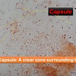 Capsule Staining: Introduction, Principle, Requirements, Procedure, Result Interpretation, Significance and Keynotes
