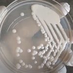 Cryptococcus neoformans: Introduction, Morphology, Pathogenecity, Lab Diagnosis,Treatment and Keynotes