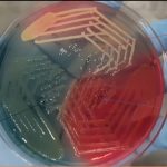 Cystine Lactose Electrolyte Deficient (CLED) Agar: Introduction, Uses,Composition, Preparation, Colony Characteristics, Modification and Limitations
