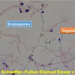 Endospore Stain Introduction, Principle, Requirements, Procedure, Result Interpretation and Keynotes