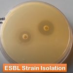 Extend Spectrum Beta-Lactamase (ESBL) strain of Escherichia coli Isolation- Introduction, Isolation Methods and Result Interpreation