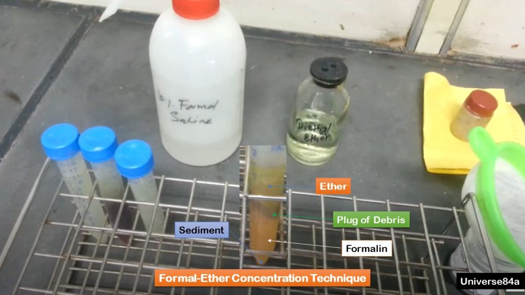 Formal-Ether Concentration Technique: Introduction, Principle, Test Requirements, Test Procedure and Uses