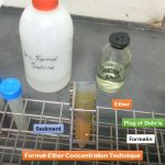Formal-Ether Concentration Technique: Introduction, Principle, Test Requirements, Test Procedure and Uses