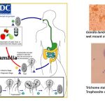 Giardia lamblia: Introduction, Morphology, Life cycle, Pathogenecity, Lab Diagnosis and Treatment