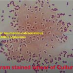 Hiss Staining for Demonstration of Bacterial Capsules:Introduction, Requirements, Procedure, Result Interpretation and Significance