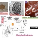 Hookworm Infection: Introduction, Morphology, life cycle, Mode of Infection, Pathogenecity, Lab Diagnosis and Treatment