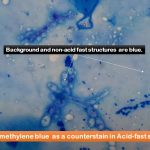 Loeffler Methylene Blue Stain: Introduction, Principle, Composition, Preparation, Staining Procedure, Result Interpretation and Keynotes