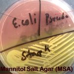 MSA: Introduction, Composition, Preparation, Test Procedure, Colony Characteristics and Keynotes