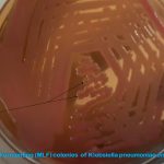 MacConkey Agar: Introduction, Principle, Composition, Preparation, Procedure, Colony Morphology and Uses