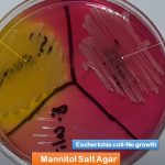 Mannitol Salt Agar: Introduction, Composition, Preparation, Colony Characteristics and Keynotes