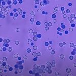 Methylene Blue Stain: Introduction, Principle, Composition, Preparation, Staining Procedure, Result Interpretation and Keynotes