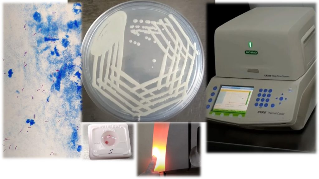 Microbiological approaches for early diagnosis of infection: Introduction and Its Applications