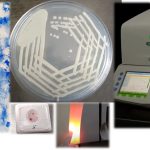 Microbiological approaches for early diagnosis of infection: Introduction and Its Applications