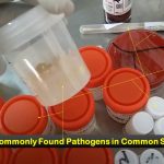 Most Commonly Found Pathogens: Introduction, List of Common Samples and Common Pathogens Found