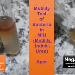 Motility: Introduction, Types, Detection Methods and Keynotes