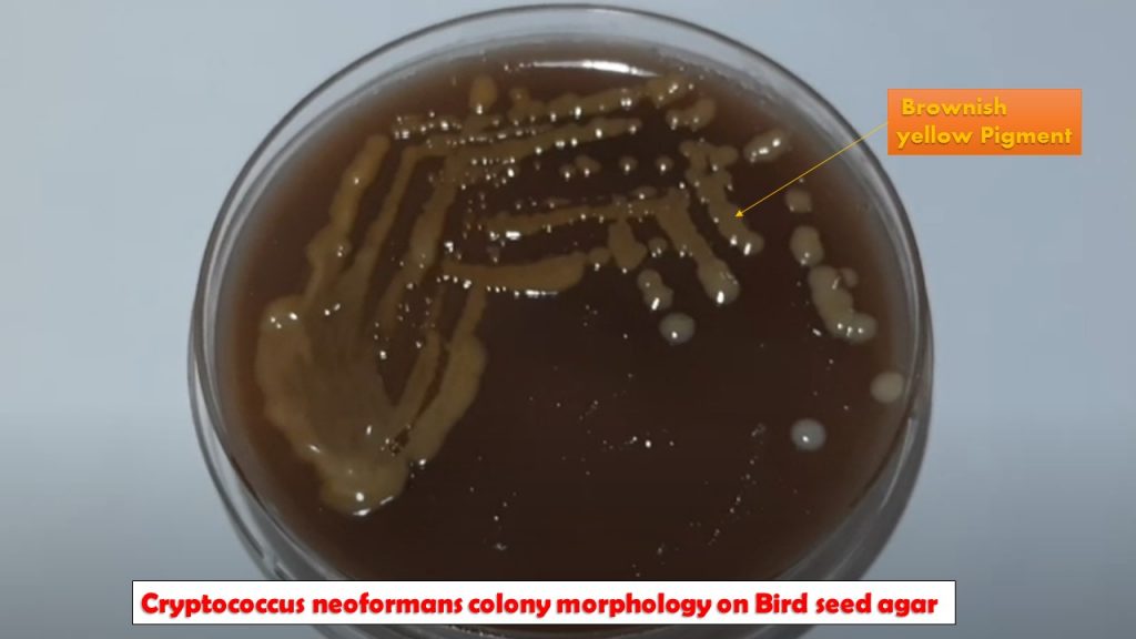 Niger Seed Agar Introduction, Principle, Composition, Test Procedure, Col