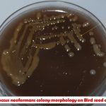 Niger Seed Agar: Introduction, Principle, Composition, Test Procedure, Colony Morphology and Uses