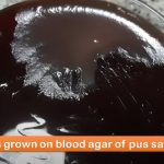 PLET Agar: Introduction, Principle, Preparation, Test Procedure, Colony Morphology and Keynotes