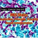 Periodic acid Schiff’s (PAS) Stain: Introduction, Principle, Procedure, Result Interpretation