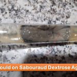 Sabouraud Dextrose Agar (SDA): Introduction, Principle, Composition, Preparation, Colony Characteristics and Uses