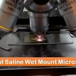 Saline Wet Mount Microscopy: Introduction, Principle, Preparation, Result Interpretation, Limitations and Related Videos