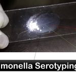 Salmonella Serotyping: Introduction, Principle, Requirements, Test Procedure, Result Interpretation and Keynotes