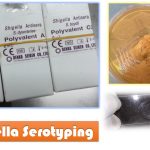 Shigella Serotyping: Introduction, Principle, Requirements, Test Procedure, Result Interpretation and Keynotes