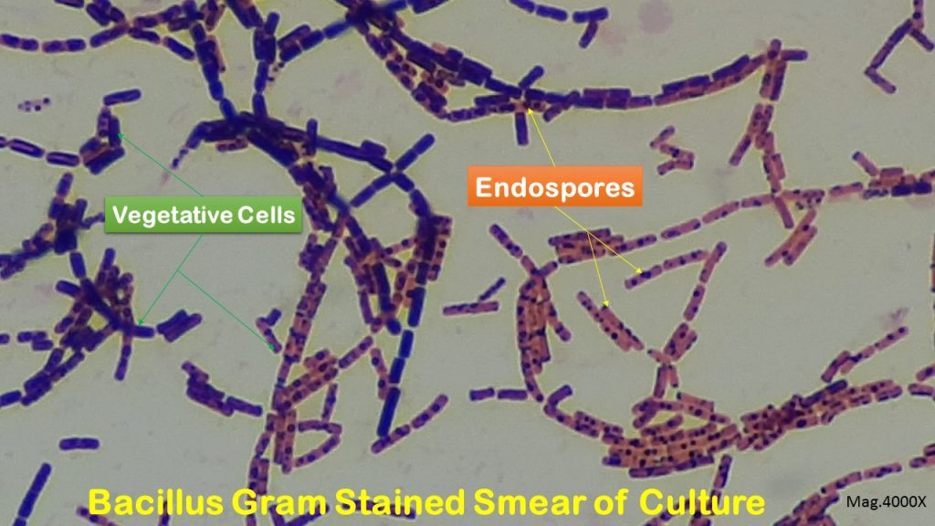 Spore Stain: Introduction, Principle, Requirements, Procedure, Result Interpretation and Keynotes