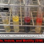 Sulfide, Indole, Motility (SIM) Test: Introduction,Principle, Procedure, Result Interpretation and Limitations